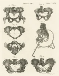 Geburtshilfe, Illustration aus 